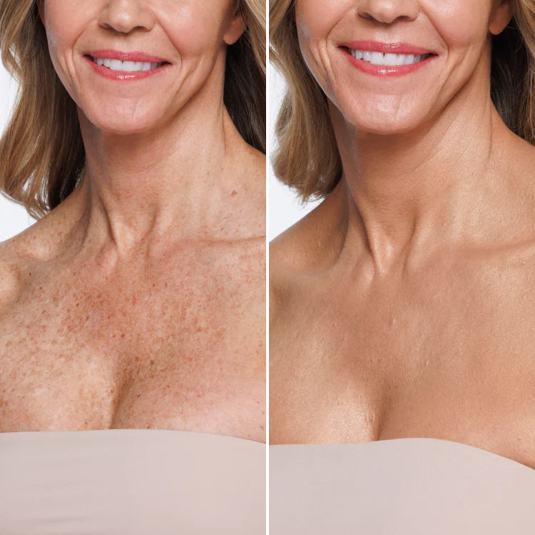 Chest before and after applying Body Coverage Perfector