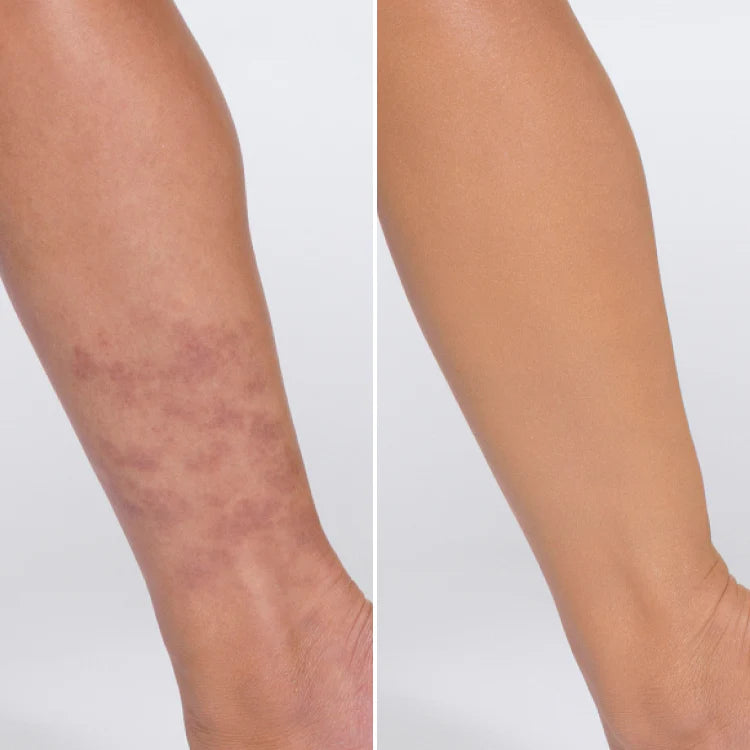 Shoulder before and after applying Body Coverage Perfector