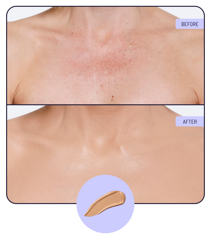 Before and after using 1C Cool Radiance