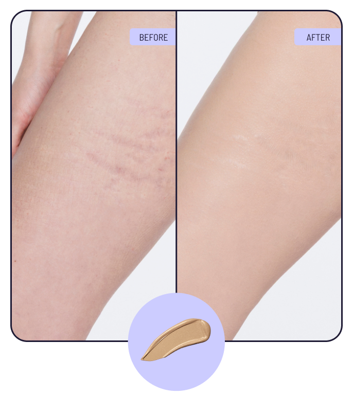 Before and after using 1N Light Radiance