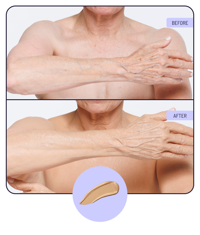 Before and after using 2W Warm Radiance