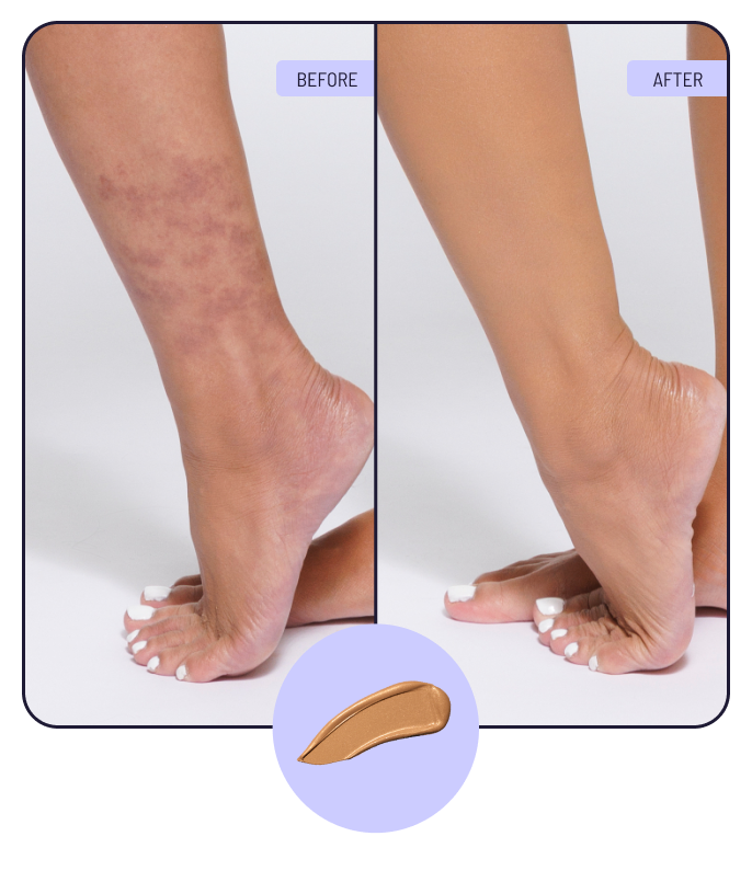 Before and after using 3N Sunlit Radiance